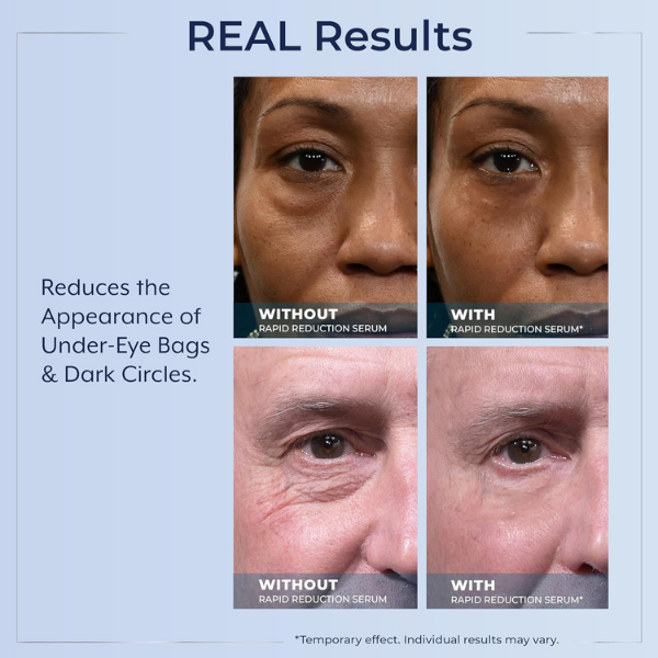 💧🌿Reduction Serum ✨Skin Firming & Lifting