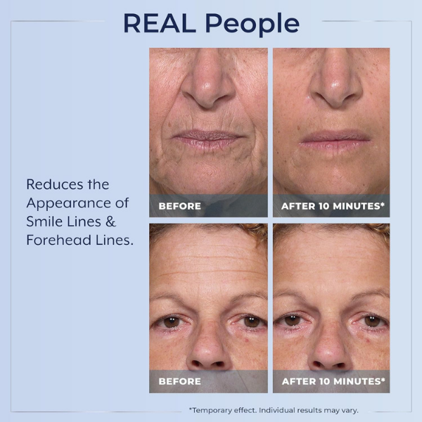 💧🌿Reduction Serum ✨Skin Firming & Lifting