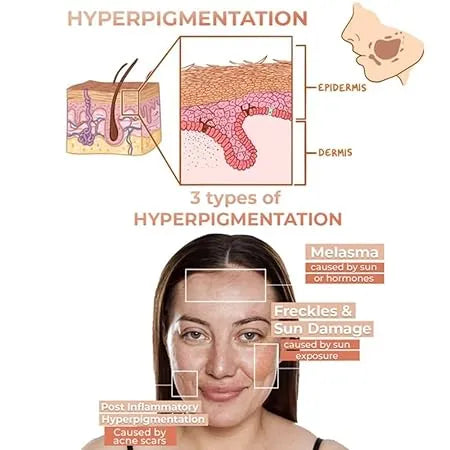 Melanin Correcting Facial Serum