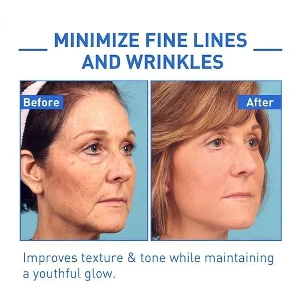 Last Day Promotion 49% OFF - đ„Botox Face Serum