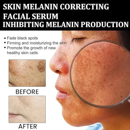 Melanin Correcting Facial Serum