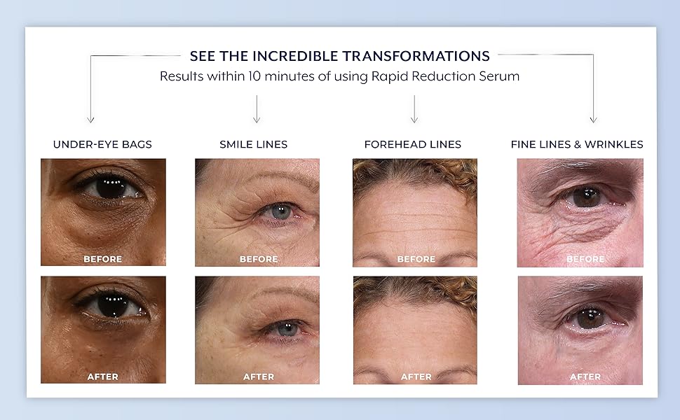 💧🌿Reduction Serum ✨Skin Firming & Lifting