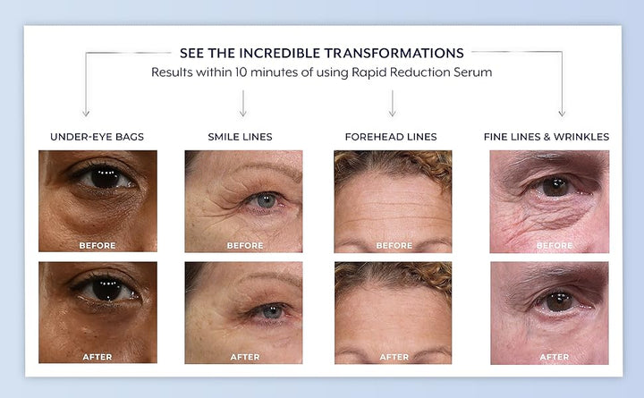 💧🌿Reduction Serum ✨Skin Firming & Lifting