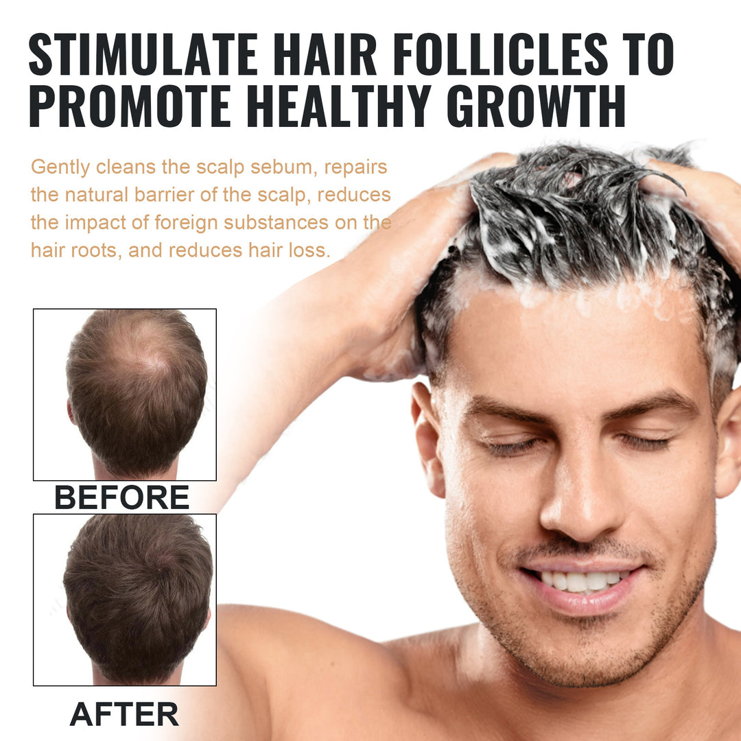EELHOE thick hair shampoo anti-hair loss smooth strong repair hair care shampoo