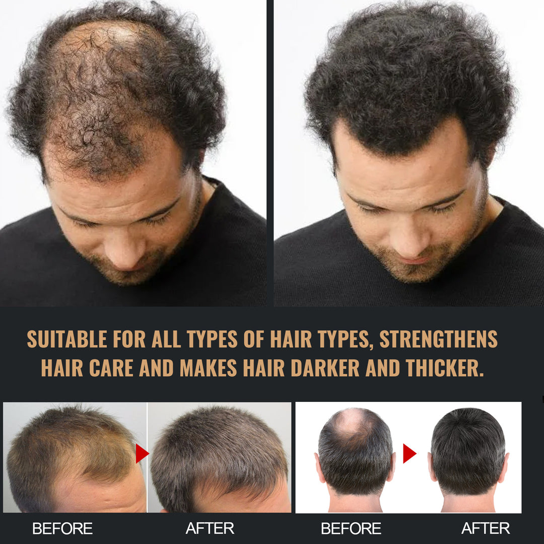 EELHOE thick hair shampoo anti-hair loss smooth strong repair hair care shampoo