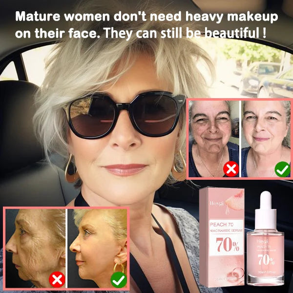 💥Daily Sales of 4000+🔥 2024 Hot Sale Niacinamide Brightening - Moisturizing & Anti-Wrinkle Serum