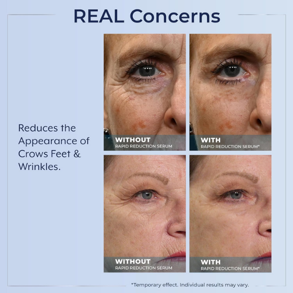 💧🌿Reduction Serum ✨Skin Firming & Lifting