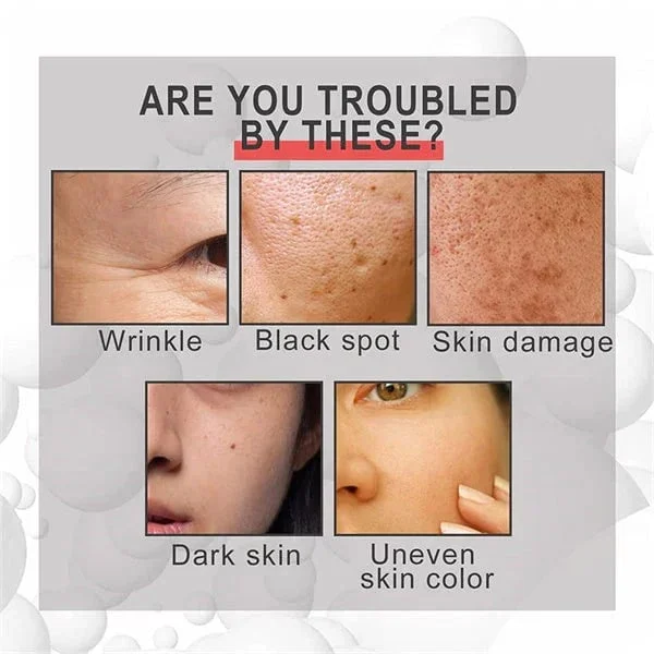 🔥Last Day Promotion 49% OFF 🔥Botox Anti-Aging Serum