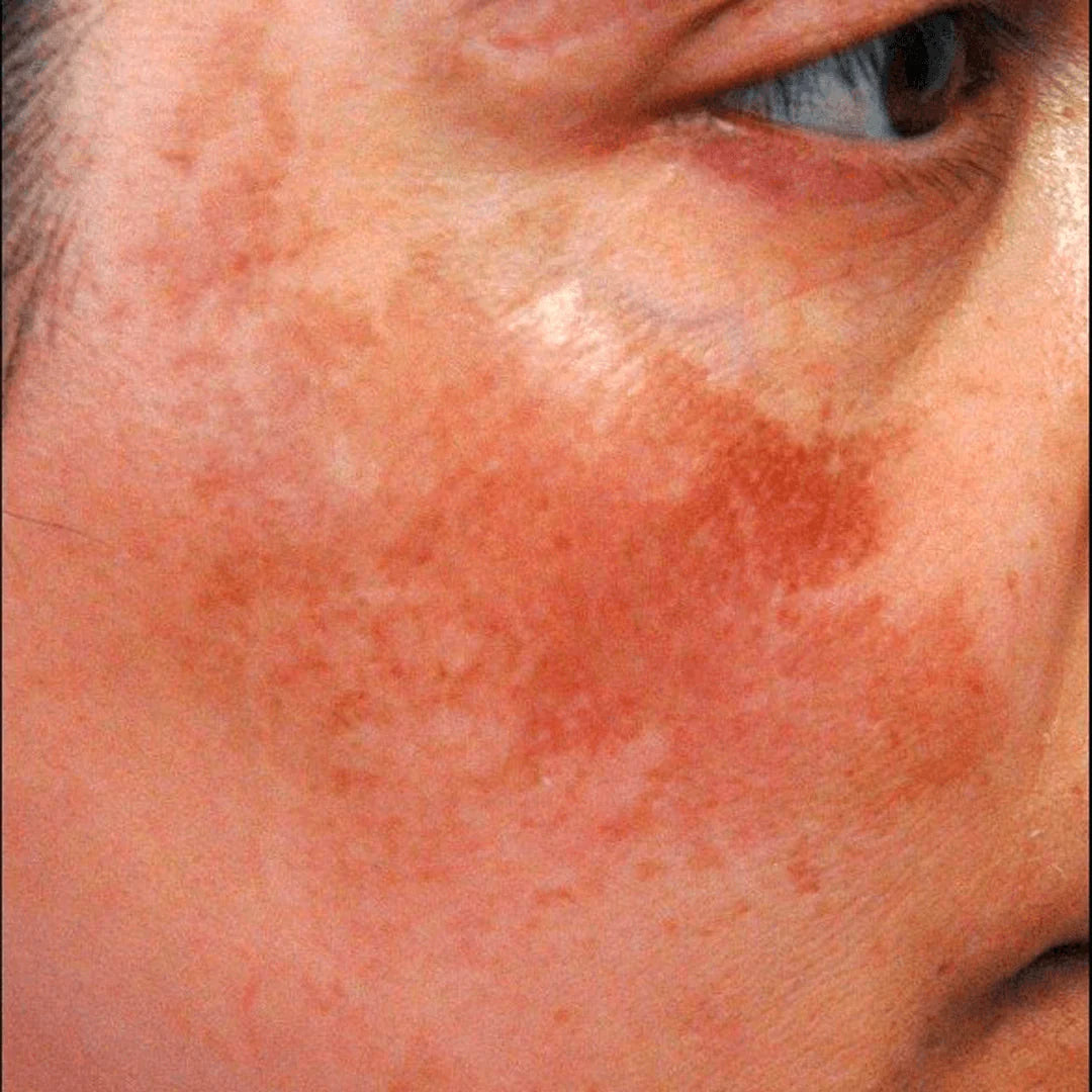 Rejuvenate Face Serum
