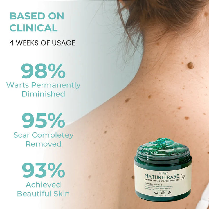 Instant Mole  Spot Removal Gel