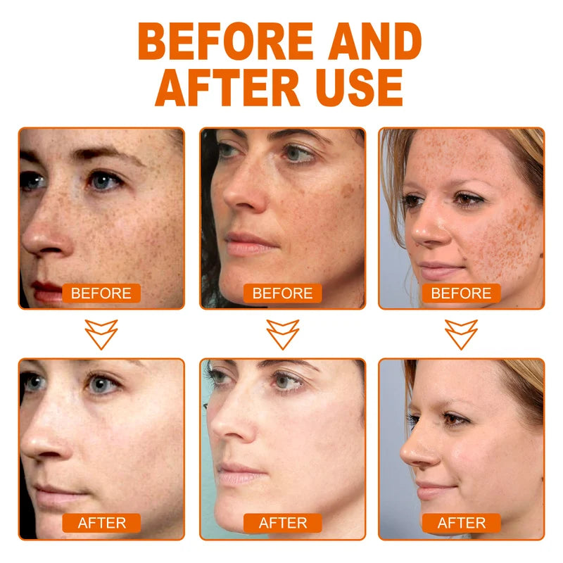New Whitening and Spot Reducing Rejuvenating Honey Tear Off Mask