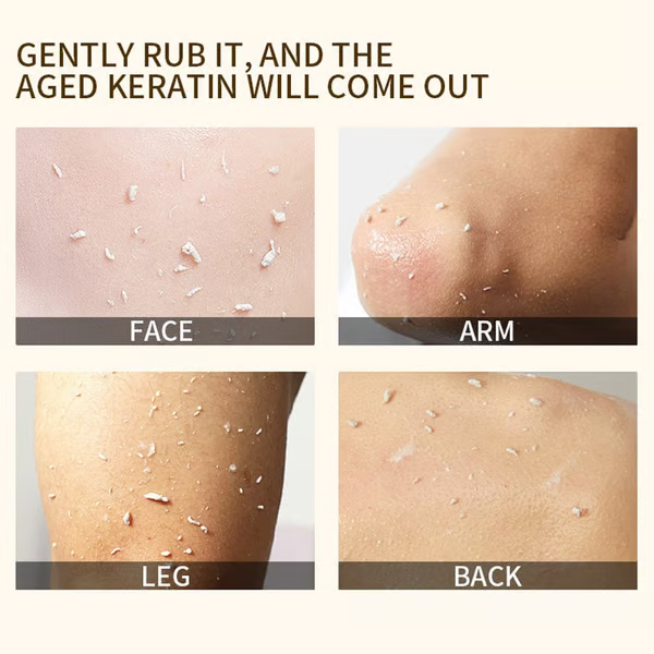 🔥Buy 1 get 1 free🔥 Orange Enzyme Exfoliating Gel 50g – Facial Cleansing Peel