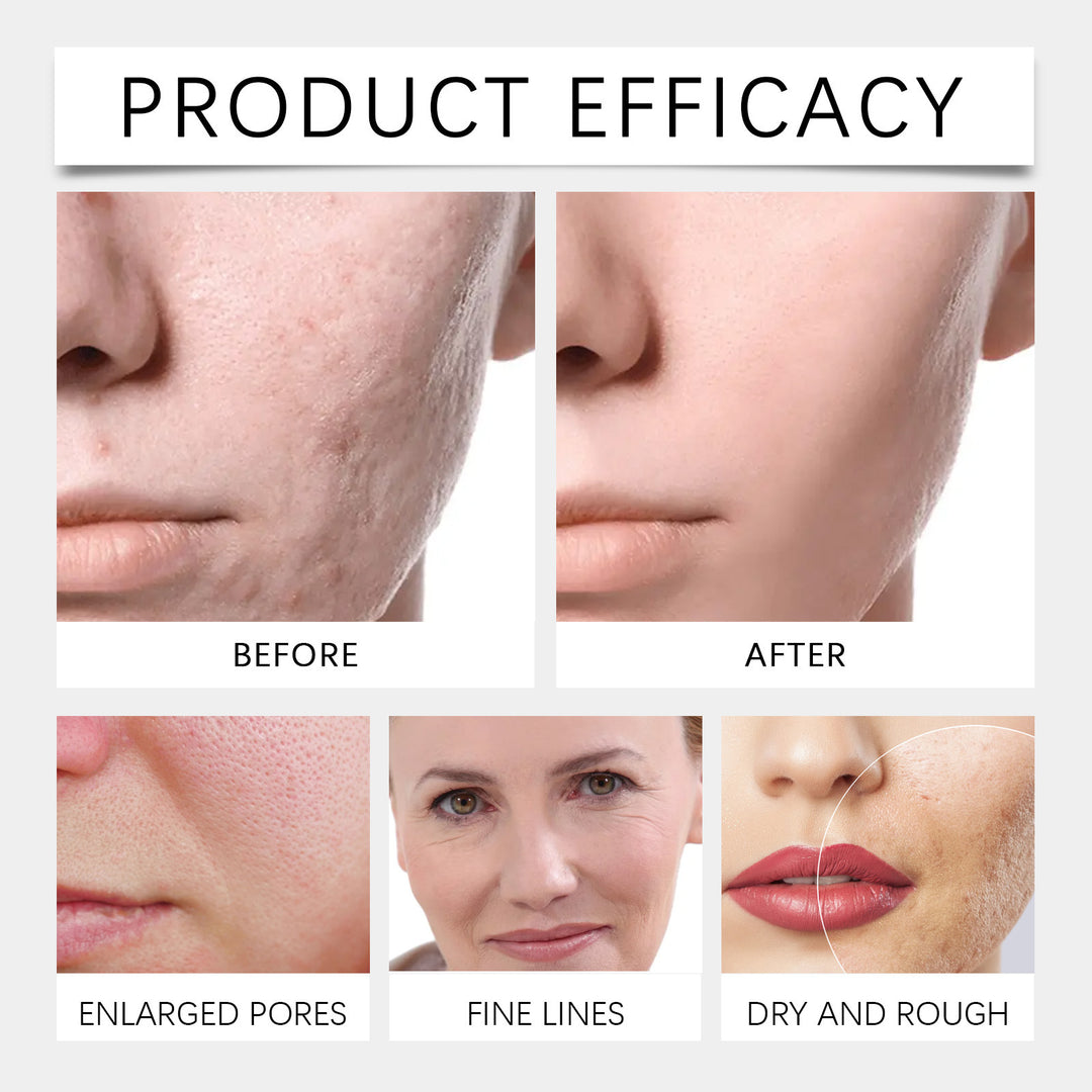 Collagen peeling mask Gentle cleansing pores Facial oil control moisturizing hydrating mask