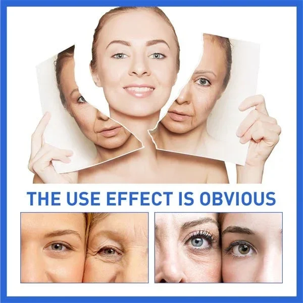 🔥Last Day Promotion 49% OFF 🔥Botox Anti-Aging Serum