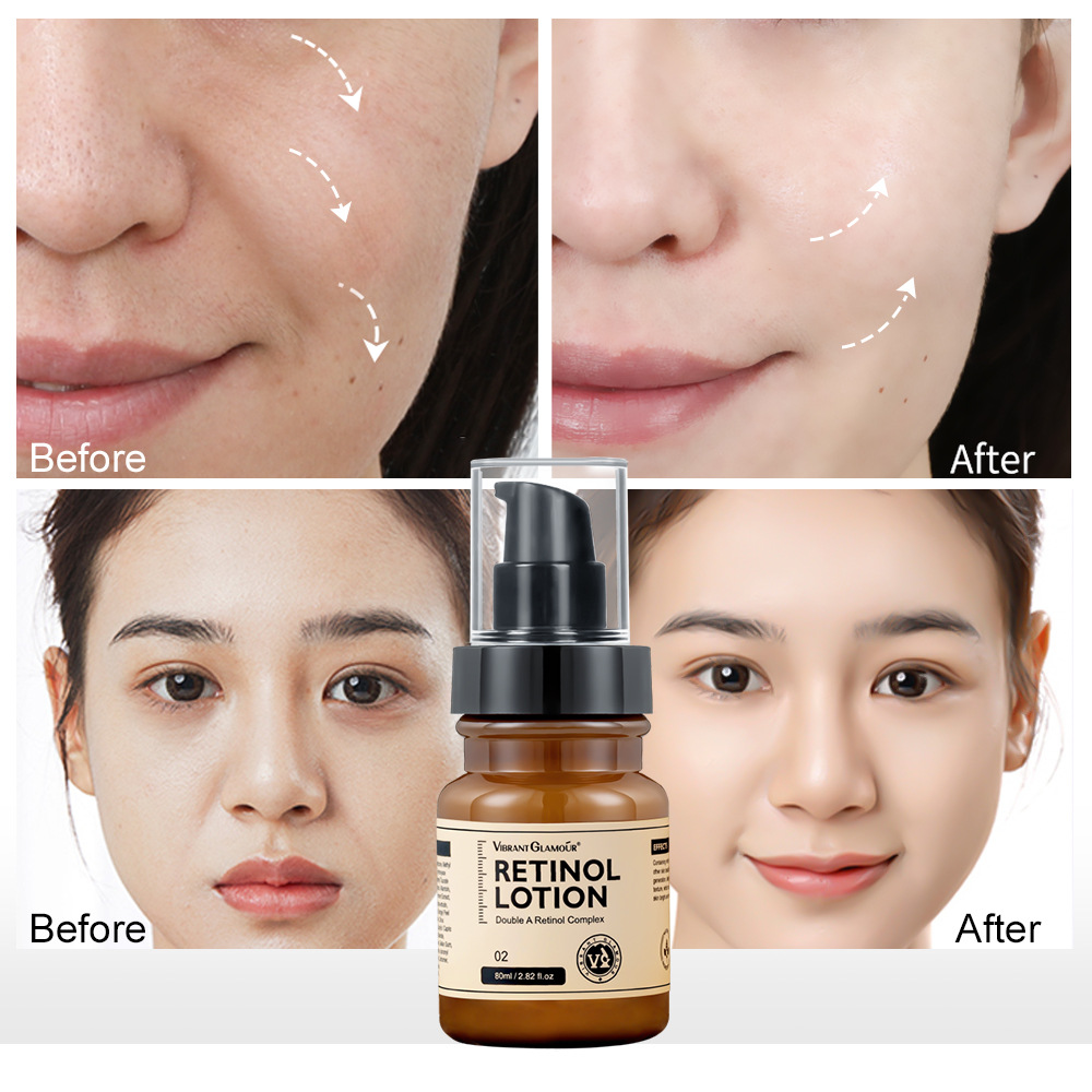 Retinol Anti Aging Kit