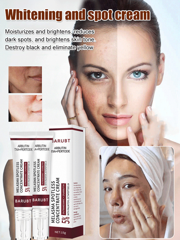 Whitening and spot cream