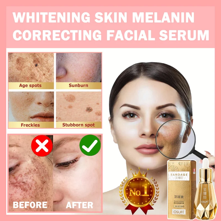 🎁2024 The Most Popular🎁 -OSUFI Whitening Skin Melanin Correcting Facial Serum[Experience Flawless Skin, Starting Here!!!]