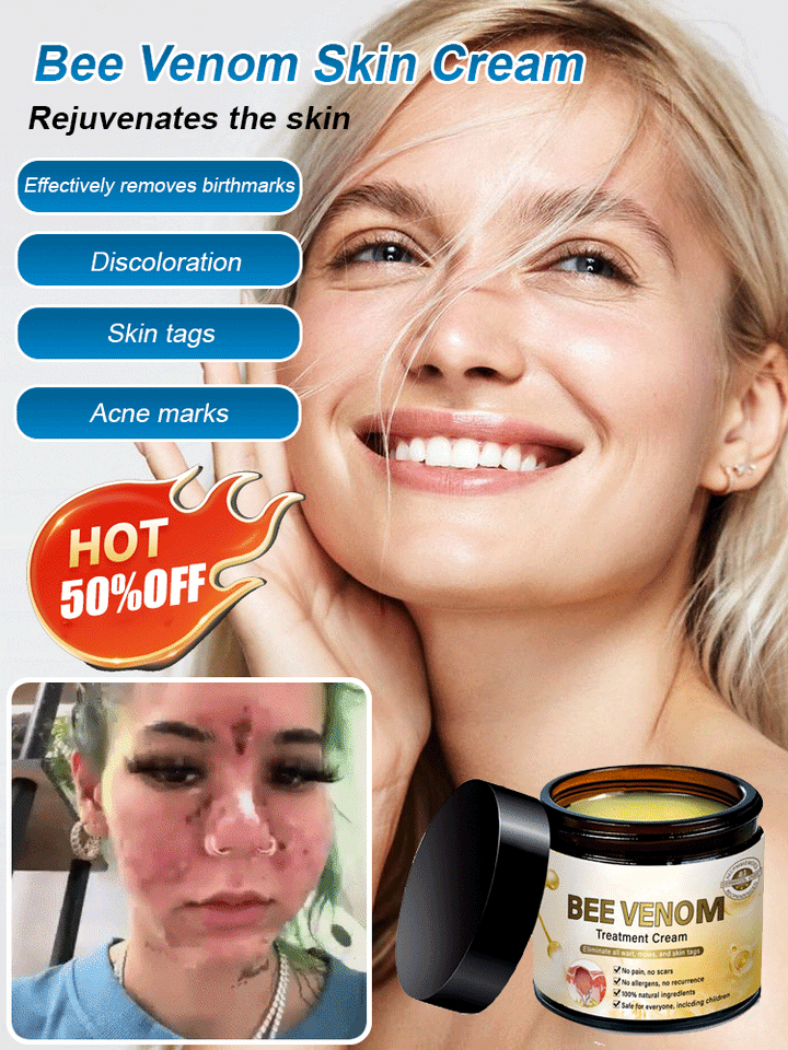Skin moss nevus and granular skin repair cream