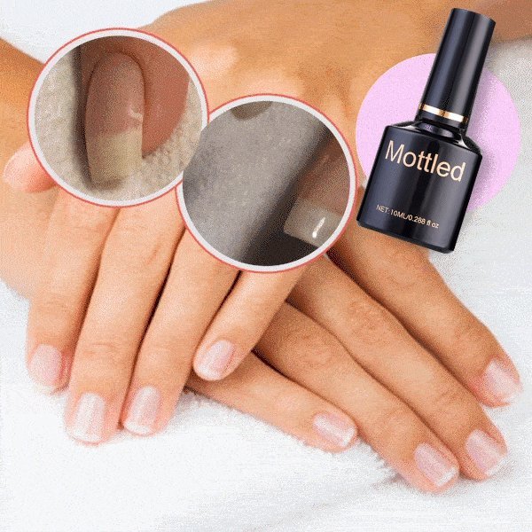 🔥Hot Sale-48% OFF-2024 NAIL REPAIR PROTECTION GEL