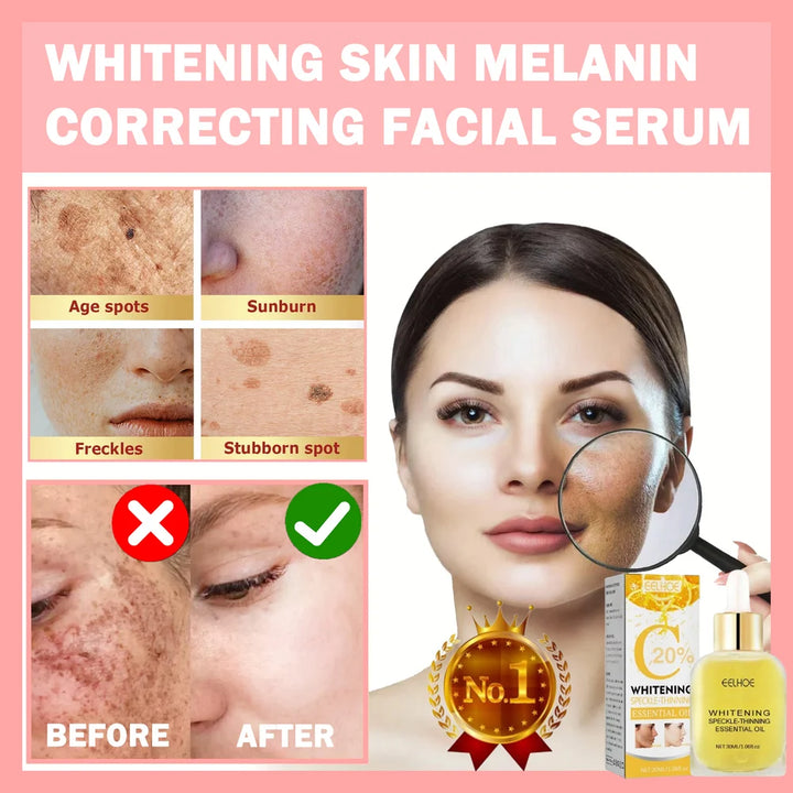Whitening Skin Melanin Correcting Facial Serum [Experience Flawless Skin, Starting Here!!!]