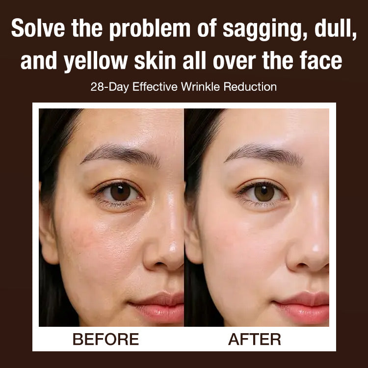 🔥BUY 1 GET 1 FREE🔥Lingzhi Anti-wrinkle Rejuvenating Water💦