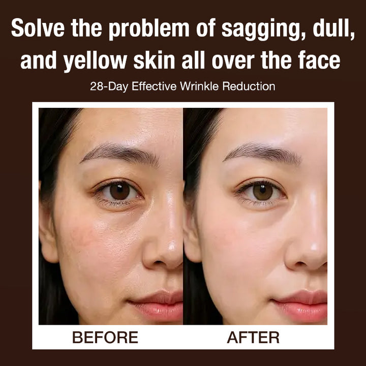 🔥BUY 1 GET 1 FREE🔥Lingzhi Anti-wrinkle Rejuvenating Water💦