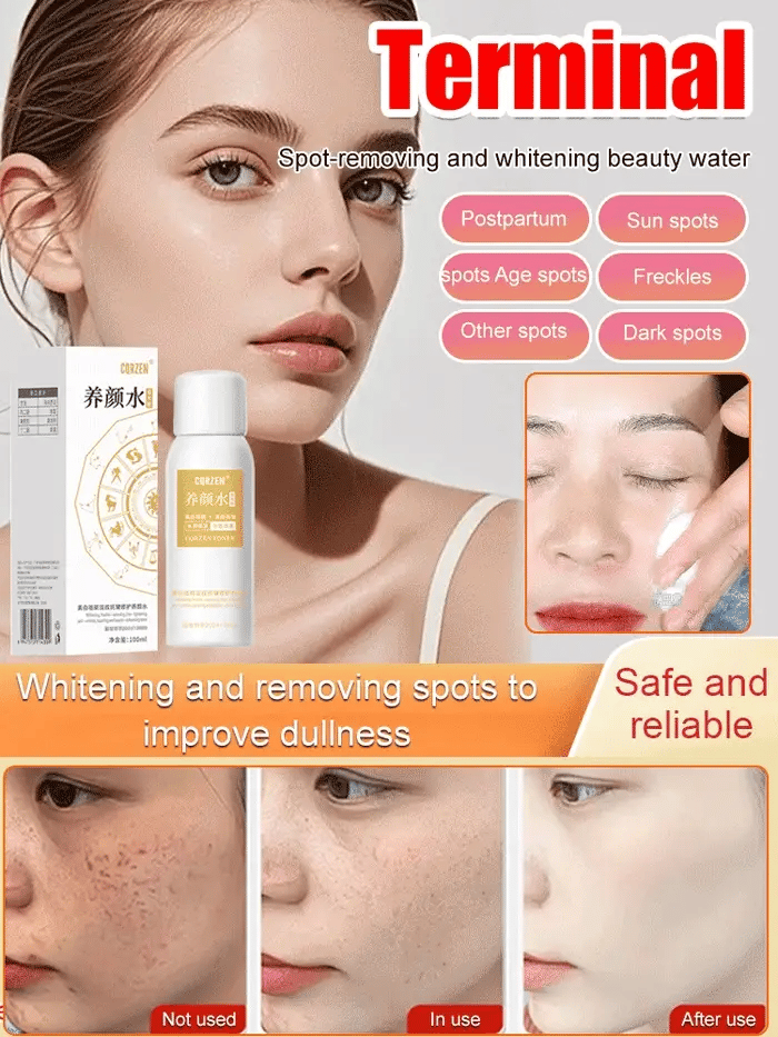 【ALL KINDS OF SPOTS CAN BE REMOVED WITH ONE SPRAY】BLEMISH REMOVAL, WHITENING AND BEAUTY WATER