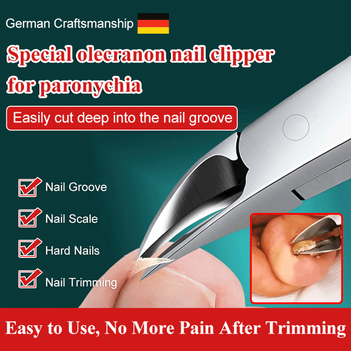 Olecranon design easy trimming