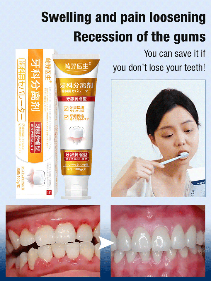 Dental separators