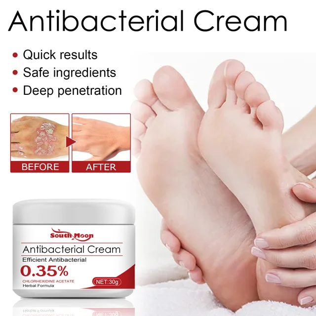 Psoriasis Treatment Cream Moss Repair Itchy Skin Relief