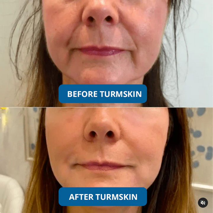 3% Hyaluron Booster for Glass Skin & Anti Aging