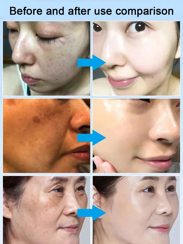 Deep Spot Remover Moisturizing Essence