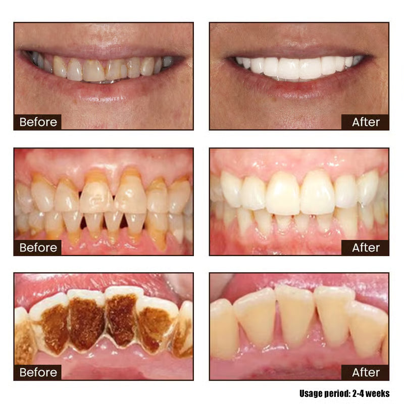 Niacinamide Whitening Toothpaste