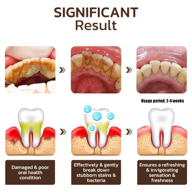 Niacinamide Whitening Toothpaste