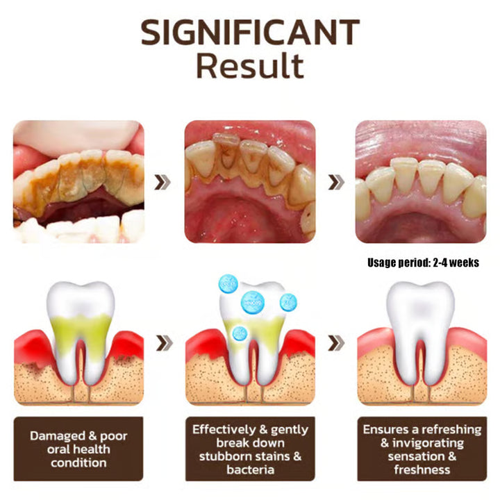 Niacinamide Whitening Toothpaste