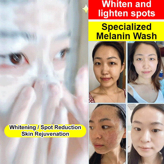 Whitening Spot Removal Brightening Niacinamide Facial Cleanser