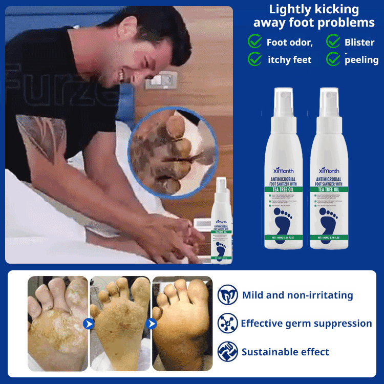 Anti-Foot Odor and Moisturizing Spray