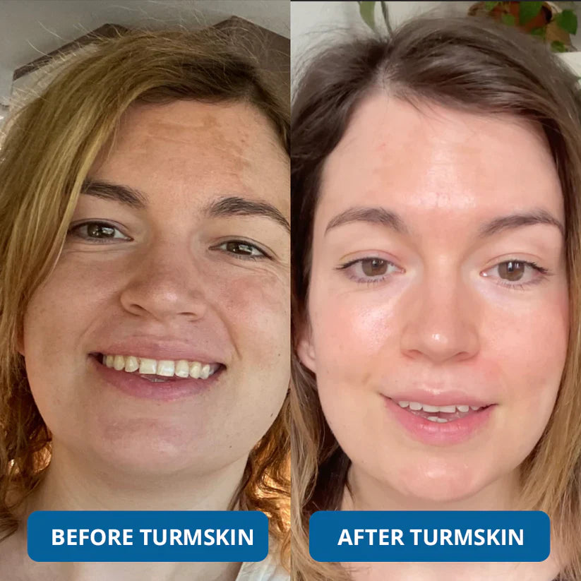 3% Hyaluron Booster for Glass Skin & Anti Aging