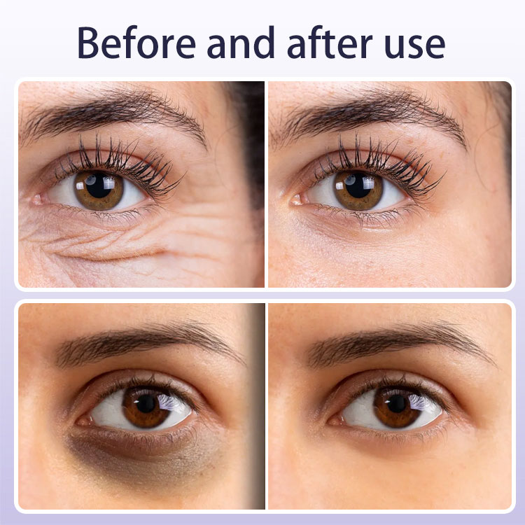 Anti-Wrinkle Firming Roll-on Eye Cream