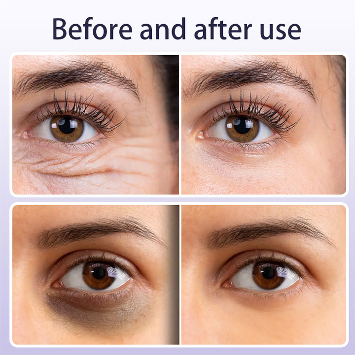 Anti-Wrinkle Firming Roll-on Eye Cream