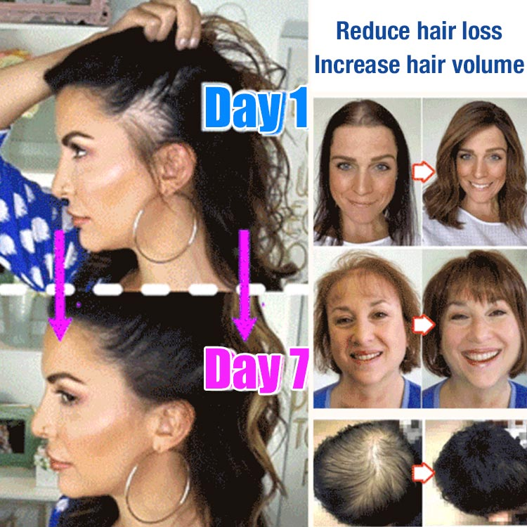 Anti hair loss serum