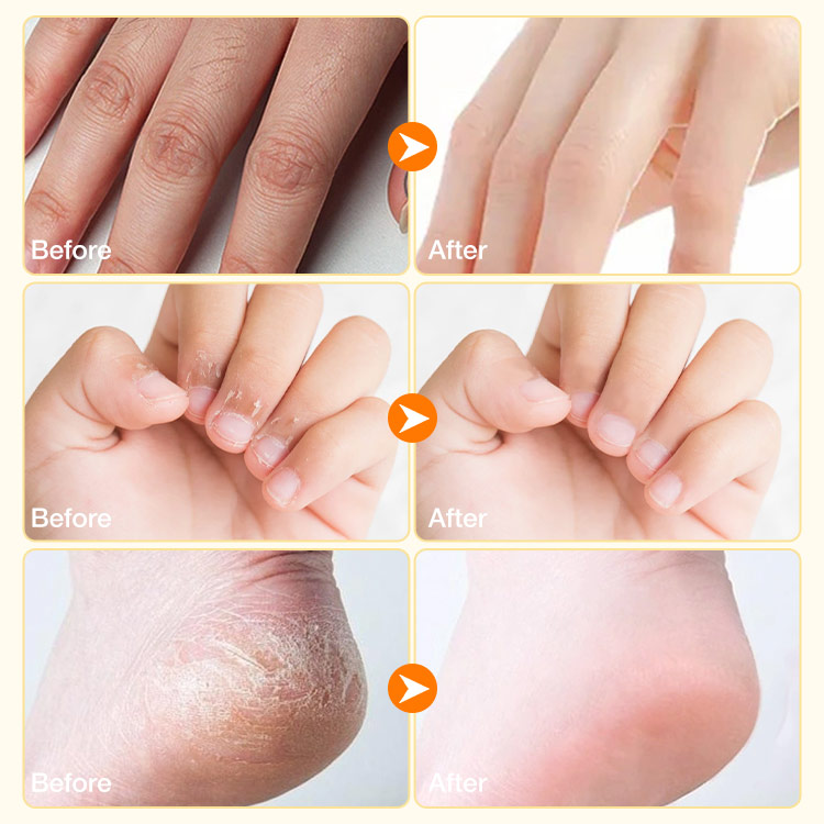 Triple Plant Hand and Foot Essence Oil