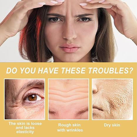 Xuerouyar Wrinkle Removal Cream