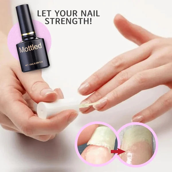 🔥Hot Sale-48% OFF-2024 NAIL REPAIR PROTECTION GEL