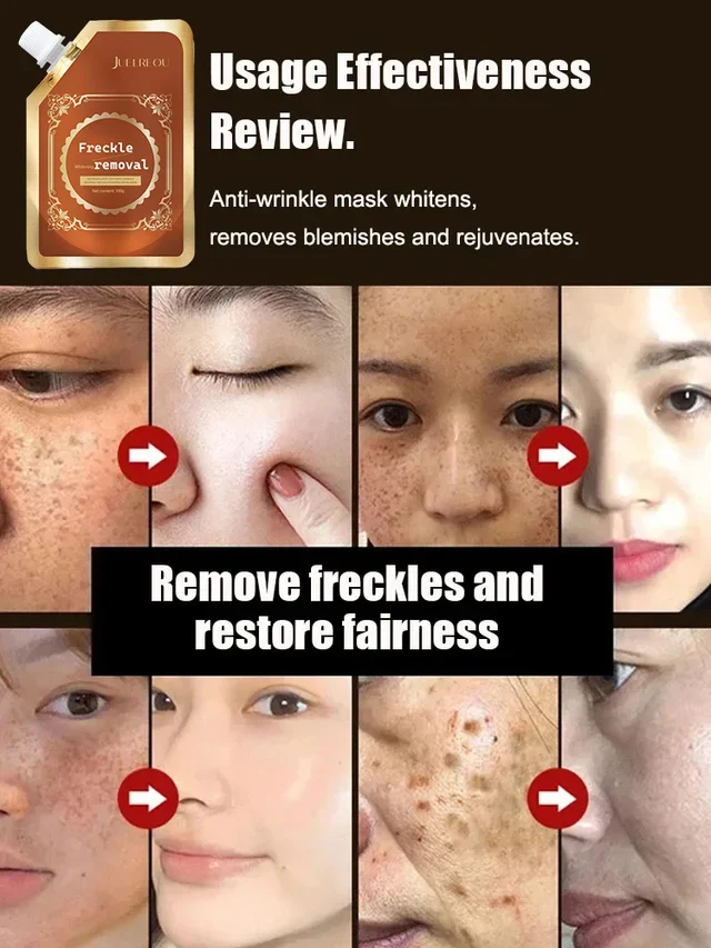 💥BIG DISCOUNT TODAY  2024 NEW ANTI BLEMISH ANTI AGING ANTI WRINKLE TEAR OFF MASK (CLINICALLY CERTIFIED)