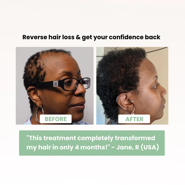 Batana Bliss Natural Hair Growth Oil