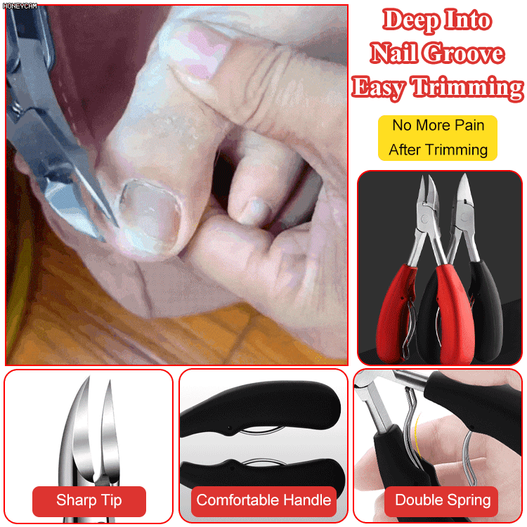 Olecranon design easy trimming