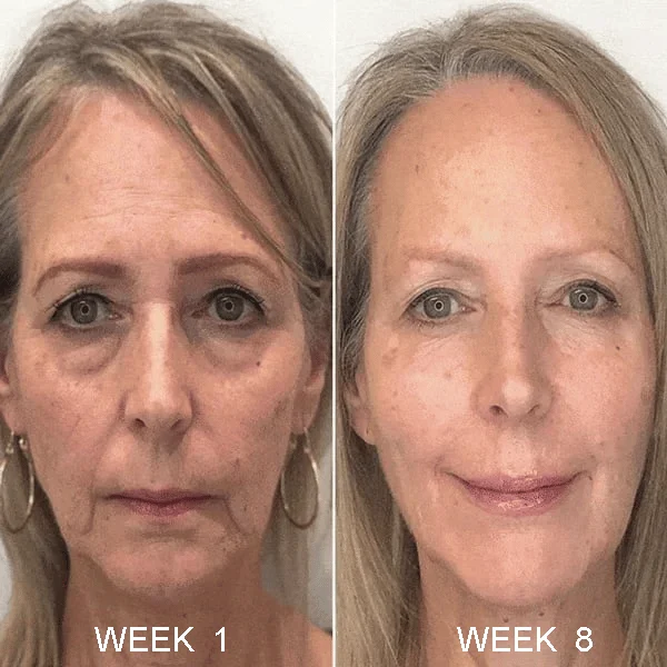 🔥Last Day Promotion 49% OFF 🔥Botox Anti-Aging Serum