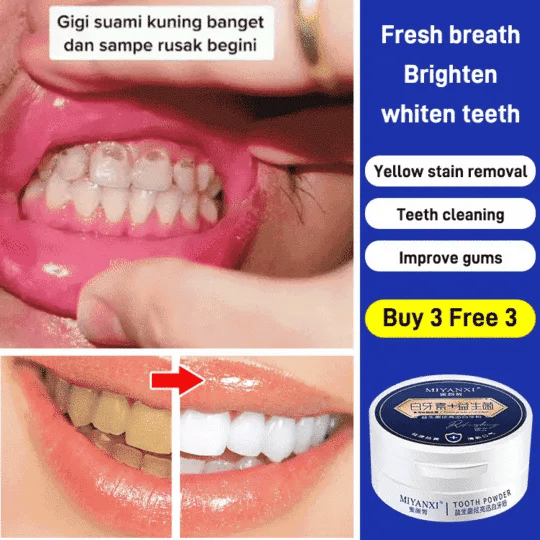 Probiotic whitening and yellowing teeth cleaning powder