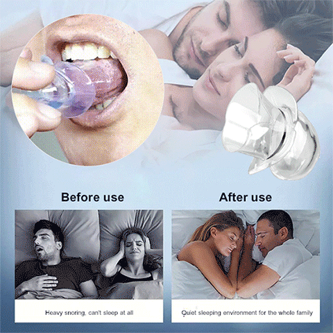 Silicone Anti-Snoring Breathing Device